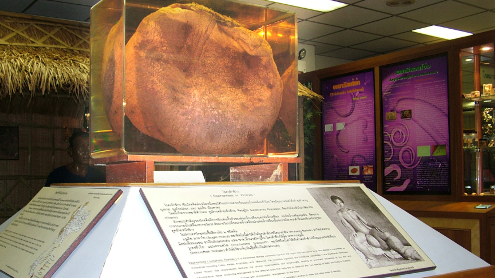 Siriraj_1-1743671593