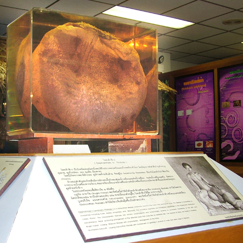 Medisch museum van Bangkok: Een teelbal van 35 kilo en andere eigenaardigheden